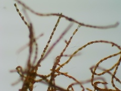 Coenogonium interplexum