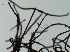 Coenogonium interplexum