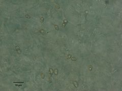 Coprinus comatus parvus