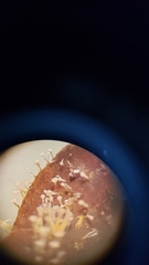 Sphaerostilbella aurifila