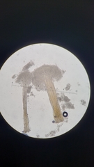 Sphaerostilbella aurifila