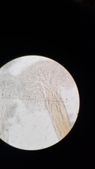 Sphaerostilbella aurifila