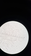 Sphaerostilbella aurifila