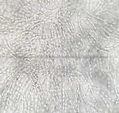 Phomatospora coprophila