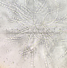 Phomatospora coprophila