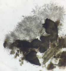 Phomatospora coprophila