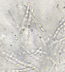 Phomatospora coprophila