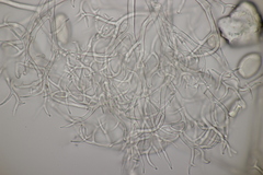 Peronospora vernalis