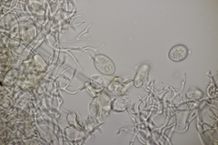 Peronospora vernalis