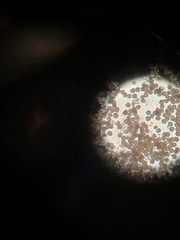 Apioperdon pyriforme