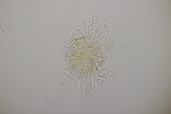 Ramularia glechomatis