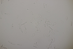 Ramularia glechomatis