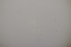 Ramularia glechomatis