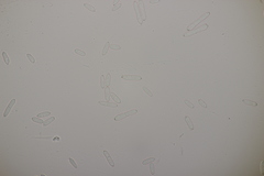 Ramularia glechomatis