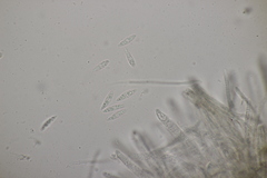 Hymenoscyphus scutula