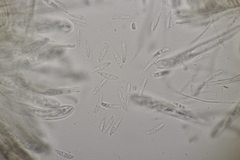 Hymenoscyphus scutula