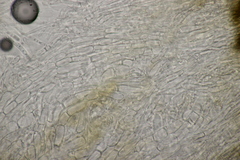 Hymenoscyphus scutula