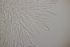 Hymenoscyphus scutula