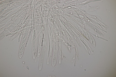 Hymenoscyphus scutula