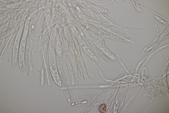 Hymenoscyphus scutula