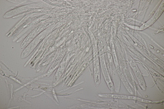 Hymenoscyphus scutula