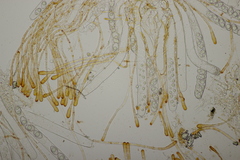 Neottiella albocincta