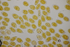 Melampsoridium carpini