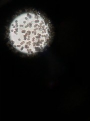 Apioperdon pyriforme