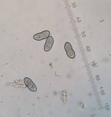 Heterodermia tremulans