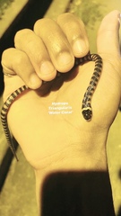 Hydrops triangularis