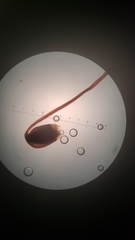 Claopodium whippleanum