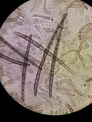 Trichoglossum hirsutum