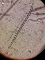 Trichoglossum hirsutum