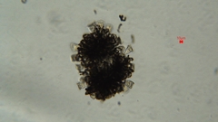 Dolichospermum lemmermannii