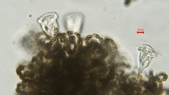 Dolichospermum lemmermannii