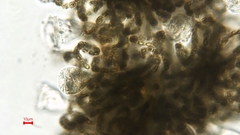 Dolichospermum lemmermannii