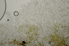 Botryobasidium capitatum