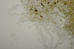 Botryobasidium capitatum