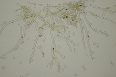 Botryobasidium capitatum