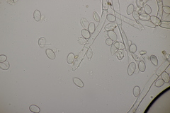 Botryobasidium capitatum