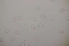 Botryobasidium capitatum