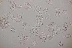 Botryobasidium capitatum