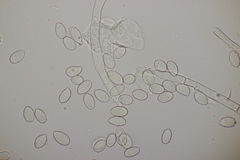 Botryobasidium capitatum
