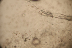 Psathyrella mucrocystis