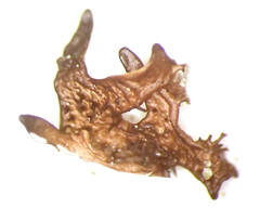 Xanthoparmelia stenophylla