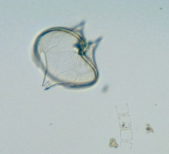Protoperidinium depressum