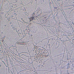 Talaromyces