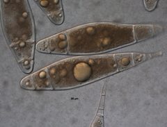 Bactridium subglandis