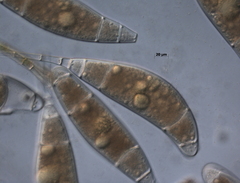 Bactridium subglandis