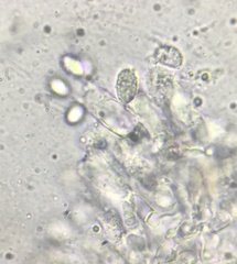 Melanoleuca polioleuca